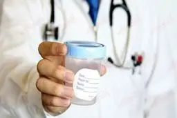 به هیچ عنوان هنگام  آزمایش ادرار و مدفوع این کارها را انجام ندهید | انجام این کارها هنگام آزمایش مدفوع و ادرار ممنوع