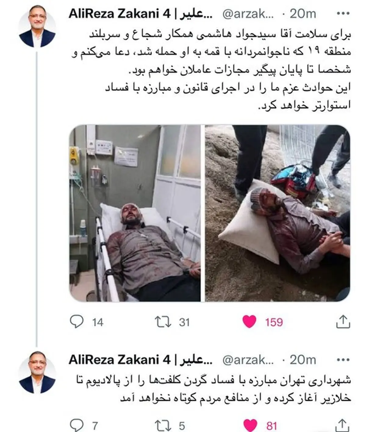 پیگیری زاکانی برای مجازات عاملان ضرب و شتم شهردار ناحیه