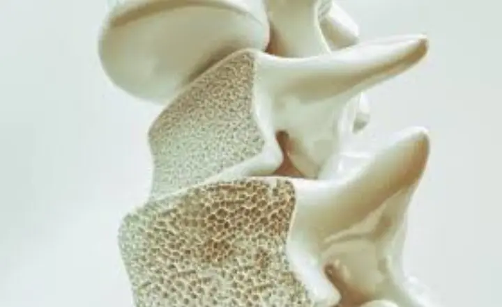 این علائم یعنی استخوان‌های شما پوک می‌شود!