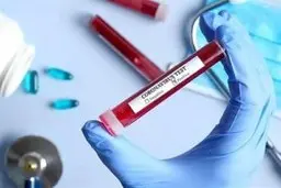 داروی ایرانی کرونا وارد مرحله آزمایش بالینی شد 