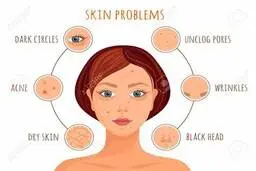 هر خوراکی چه مشکل پوستی ایجاد میکنه؟ | چه چیزهایی را باید محدود کنیم؟ +ویدئو