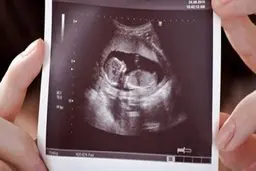 طرح جوانی جمعیت یا تولد سالانه ۷۰۰ نوزاد دارای معلولیت؟