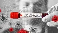 امروز آزمایش ویروس کرونای بیش از 90 هزار انسان در 58 کشور مثبت اعلام شده
