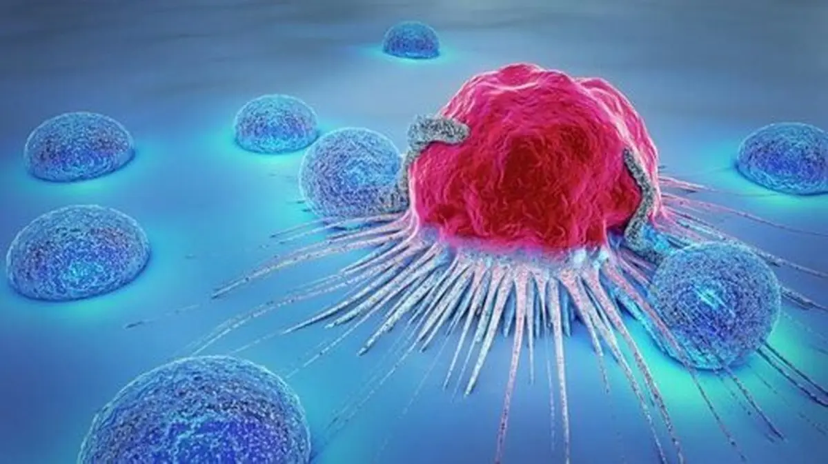 رایج‌ترین علائم ابتلا به سرطان سینه در مردان 