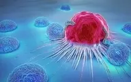 رایج‌ترین علائم ابتلا به سرطان سینه در مردان 