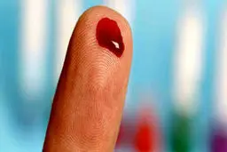 علائم غلظت خون چیست؟ 