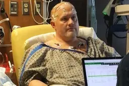 معجزه علم در درمان افسردگی | مردی پس از ۳۰ سال با ایمپلنت مغزی طعم شادی را چشید