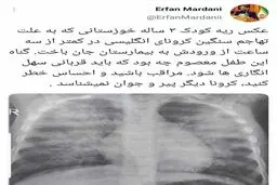 کودک ۳ ساله مبتلا به کرونا در خوزستان، کمتر از ۳ ساعت پس از رسیدن به بیمارستان جان باخت‌