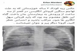 کودک ۳ ساله مبتلا به کرونا در خوزستان، کمتر از ۳ ساعت پس از رسیدن به بیمارستان جان باخت‌