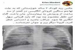کودک ۳ ساله مبتلا به کرونا در خوزستان، کمتر از ۳ ساعت پس از رسیدن به بیمارستان جان باخت‌
