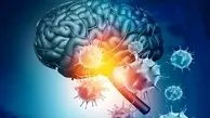 ویروس کرونا قشر خاکستری مغز را تغییر می‌دهد 