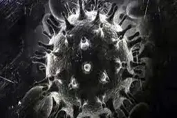  ۵ بیمار مبتلا به قارچ سیاه در لرستان فوت شدند