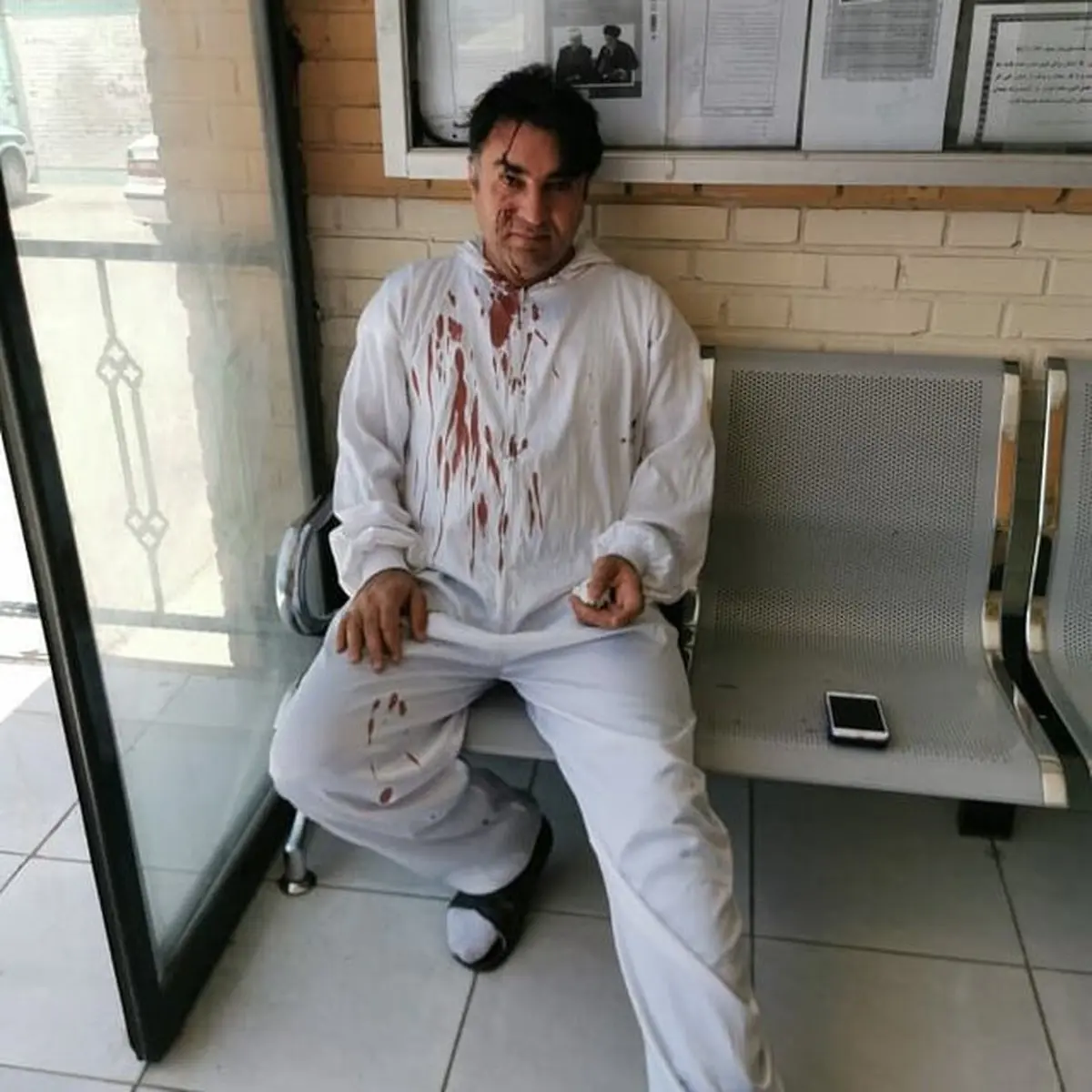  پزشک یاسوجی | بازداشت ۲ نفر متهم به ایراد ضرب و جرح 