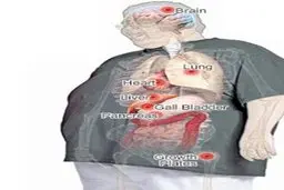 کرونا در بدن افراد چاق پنهان می‌شود تا در زمان مناسب ضربه بزند