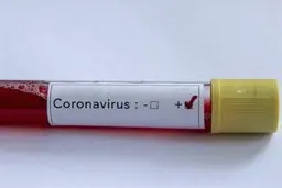 بهبودی ۱۵ عضو باشگاه سپیدرود رشت از کرونا