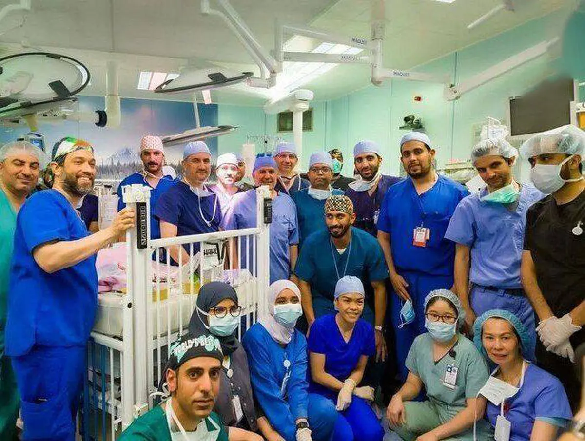 این دو قلو ها بعد ۱۵ ساعت عمل جراحی  از هم جدا شدند+ تصویر