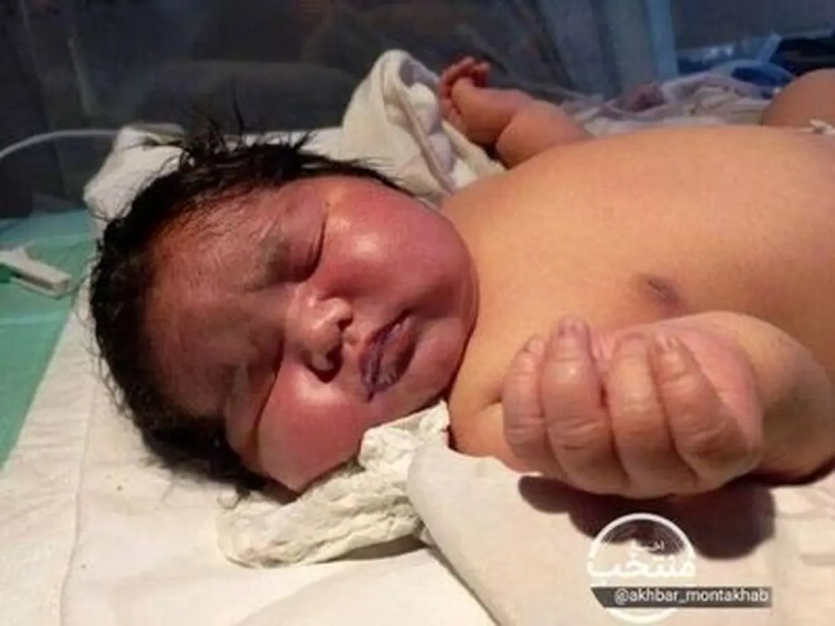 تولد یک نوزاد باورنکردنی در مشهد +عکس