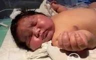 تولد یک نوزاد باورنکردنی در مشهد +عکس