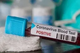 چرا کرونا در هند چندان شیوع پیدا نکرده است؟