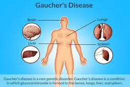 خبر خوب برای کرونا
