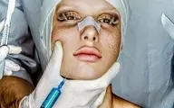 
بازار میلیاردی جراحی زیبایی در ایران

