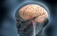 سکته مغزی رابطه مستقیم با گروه خونی انسان دارد