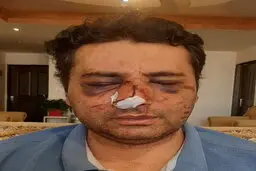  همراهان بیمار متخصص بیهوشی در شهر پیرانشهر  راموردضرب و شتم شدید قراردادند