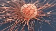5 سپر قوی در برابر سلول سرطانی | این سلول مضر با مصرف این خوراکی‌ها تار و مار میشه!