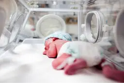 به دنیا آمدن یک موجود عجیب الخلقه | انسان است یا پری دریایی ؟