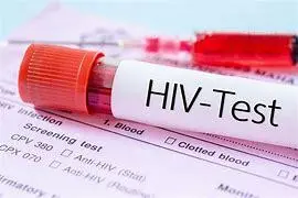 آخرین وضعیت HIV/AIDS در کشور | انقلاب در درمان ایدز