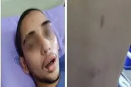 تصاویر دلخراش از شکنجه پسر عقب افتاده