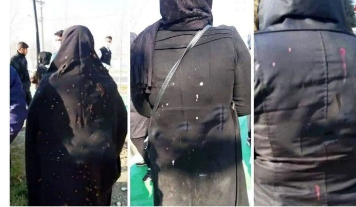 پلیس: عامل اسیدپاشی به سه زن در اندیشه شهریار، یک زن با ماسک بود؛ تلاش برای دستگیری او ادامه دارد | یکی از زنان از ناحیه پشت پا و دست دچار سوختگی شده