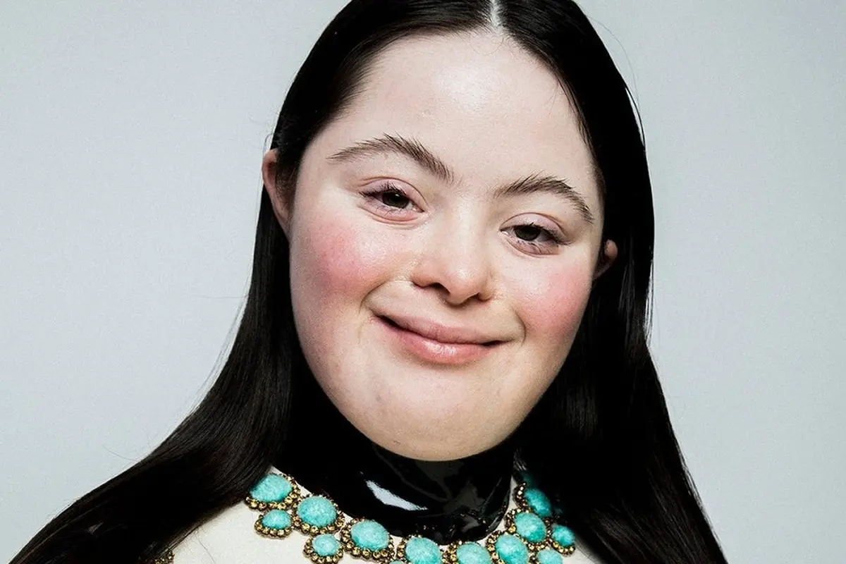 الی گلداشتاین"یک مدل جدید نوجوان که به سندرم داون مبتلا است 