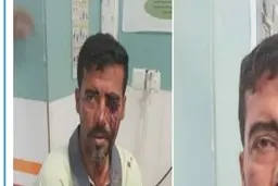 زخمی شدن پاکبان خرمشهری |  علت درگیری و ضرب و شتم + عکس