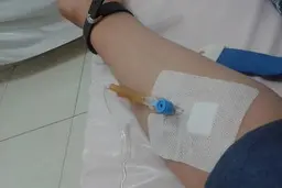 واکنش سازمان غذا و دارو به کمبود سِرُم تزریقی: سرم‌سازان قول داده‌اند کمبود را جبران کنند | تولید سرم به ۱۱ میلیون در ماه رسیده و تا اواخر شهریور به ۱۵.۵ میلیون افزایش می‌یابد