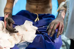 آمار حوادث چهارشنبه سوری: ۱۹ فوتی و ۲۸۰۰ مصدوم |  حال ۳۴ نفر وخیم است | قطع عضو ۱۷۱ نفر | ۸۷۴ نفر دچار آسیب چشم شدند