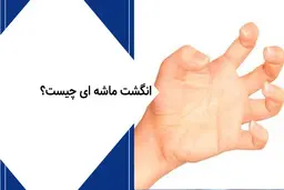 عارضه انگشت ماشه‌ای چیست؟ | خطرات پنهان بازی همستر کامبت در کمین جوانان