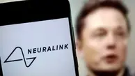  انقلابی در درمان نابینایی | FDA به دستگاه Neuralink مجوز داد | بینا شدن افراد نابینای مادرزاد به گفته های ایلان ماسک!