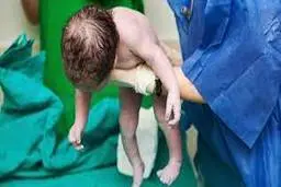 آلودگی هوا باعث افزایش مرده زایی در کشور شد | نوزادان به علت الودگی هوا کشته می‌شوند