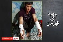 چهره یک قهرمان واقعی