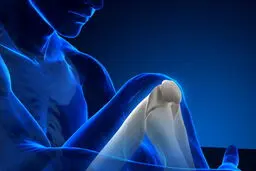 افزایش قابل توجه پوکی استخوان پس از ۵۰ سالگی