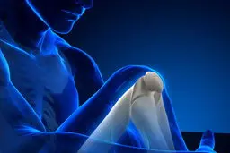 افزایش قابل توجه پوکی استخوان پس از ۵۰ سالگی