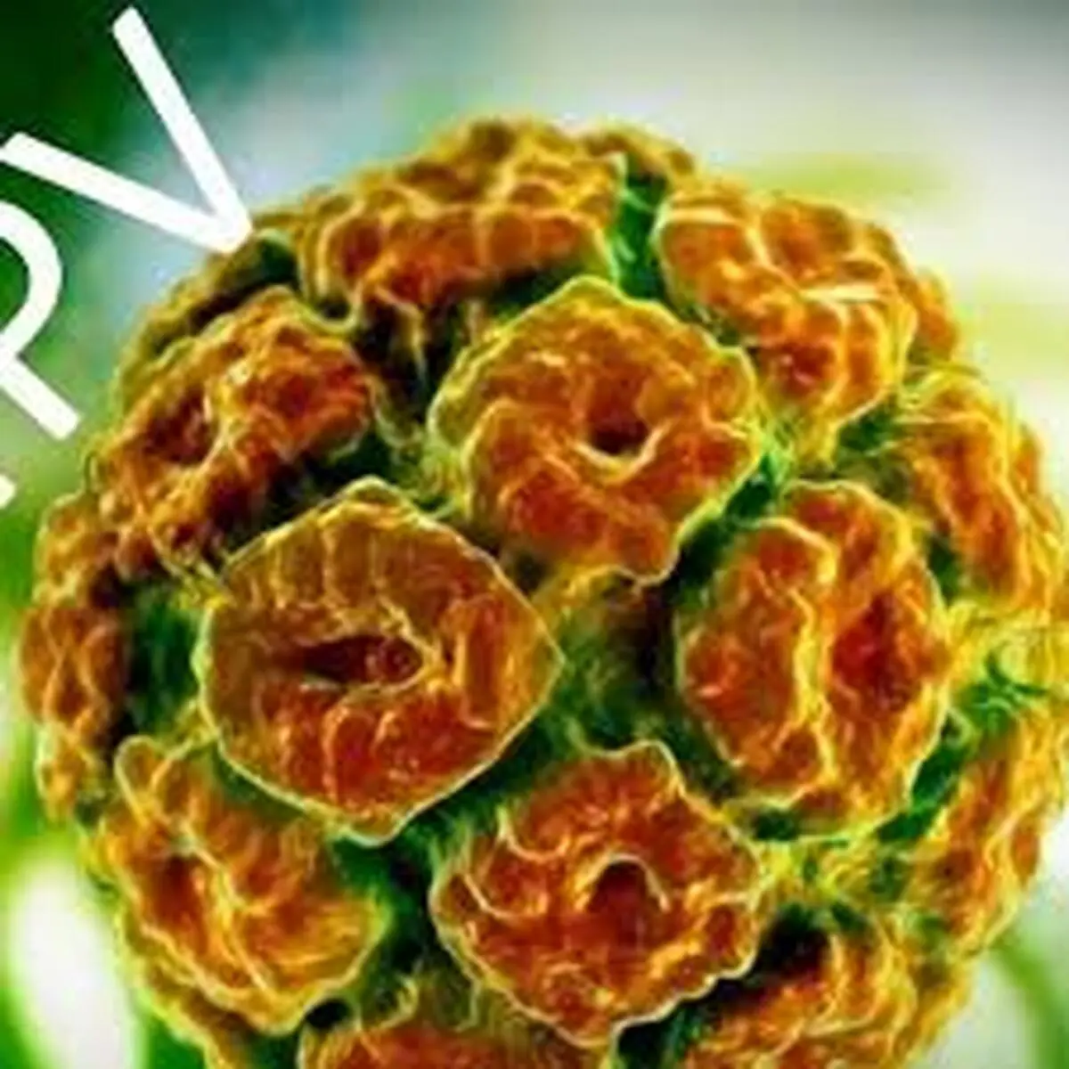 درمان زگیل تناسلی  |  تاثیرپماد عصاره برگ چای سبز بر بهبود زگیل تناسلی 