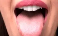 سرطان زبان را با این ۳ نشانه تشخیص دهید