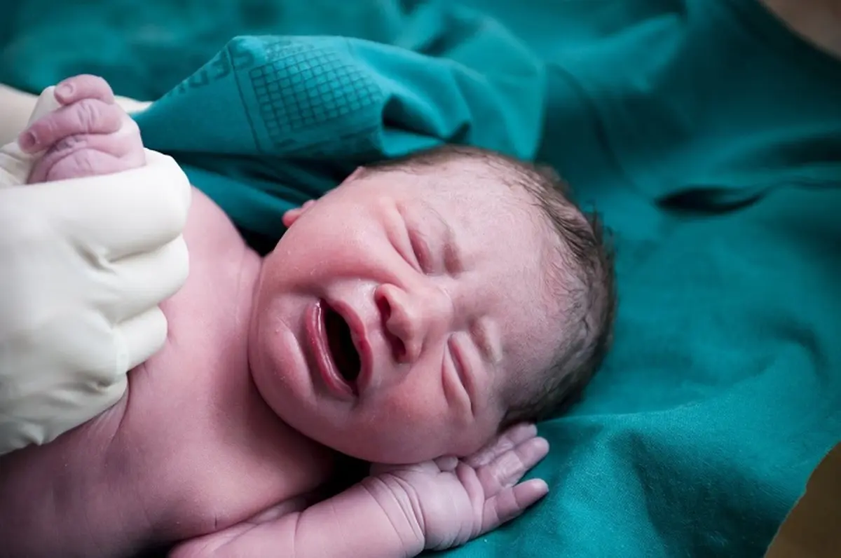 متولد شدن عجیب ترین نوزاد با ۲ صورت! | این راز بزرگ نباید فاش میشد! +ویدئو