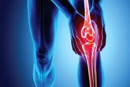 تشخیص پوکی استخوان با هوش مصنوعی | دقت ۸۶٪ با تحلیل تصاویر اشعه ایکس 