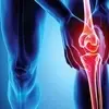 تشخیص پوکی استخوان با هوش مصنوعی | دقت ۸۶٪ با تحلیل تصاویر اشعه ایکس 