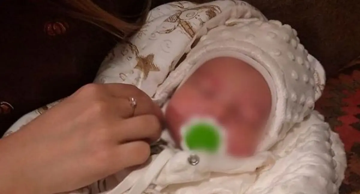 اقدام عجیب مادر بی رحم | این مادر نوزادش را برای عمل زیبایی بینی فروخت + عکس های قبل و بعد از عمل