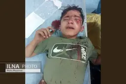 چشم مانی هاشمی کولبر ۱۴ ساله عمل شد | او را به تهران منتقل کردند