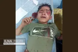 چشم مانی هاشمی کولبر ۱۴ ساله عمل شد | او را به تهران منتقل کردند